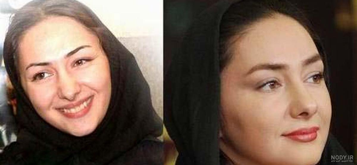 عمل بینی باران کوثری