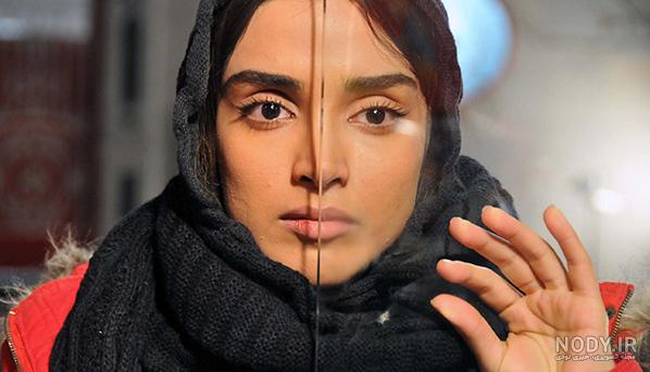 عکس الهه حصاری قبل از عمل عکس الهه حصاری قبل از عمل