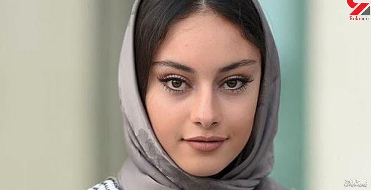 عکس ترلان پروانه در پیشونی سفید عکس ترلان پروانه در پیشونی سفید