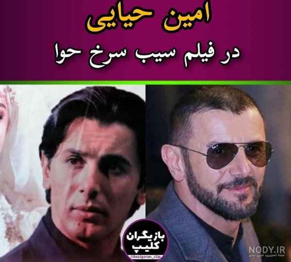 عکس حمید گودرزی قبل از عمل بینی