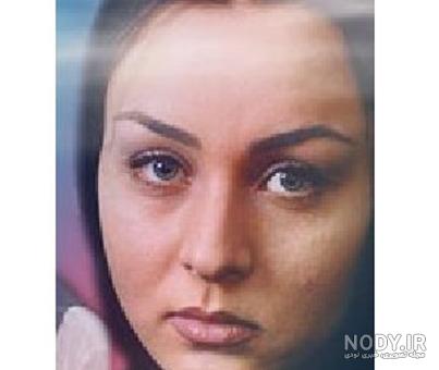 بیماری حدیث فولادوند بیماری حدیث فولادوند