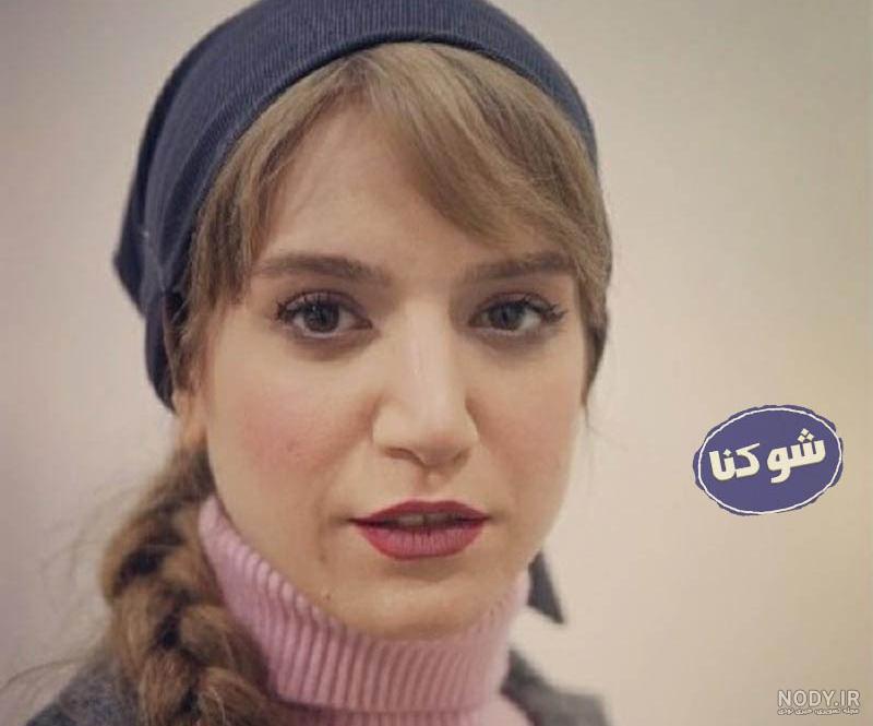 سن ستاره پسیانی سن ستاره پسیانی