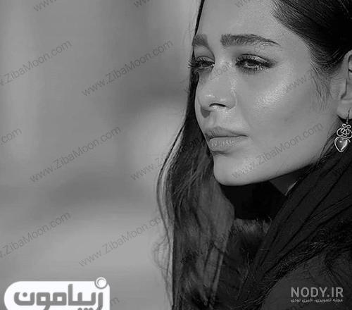 عکس سانیا سالاری قبل از عمل بینی