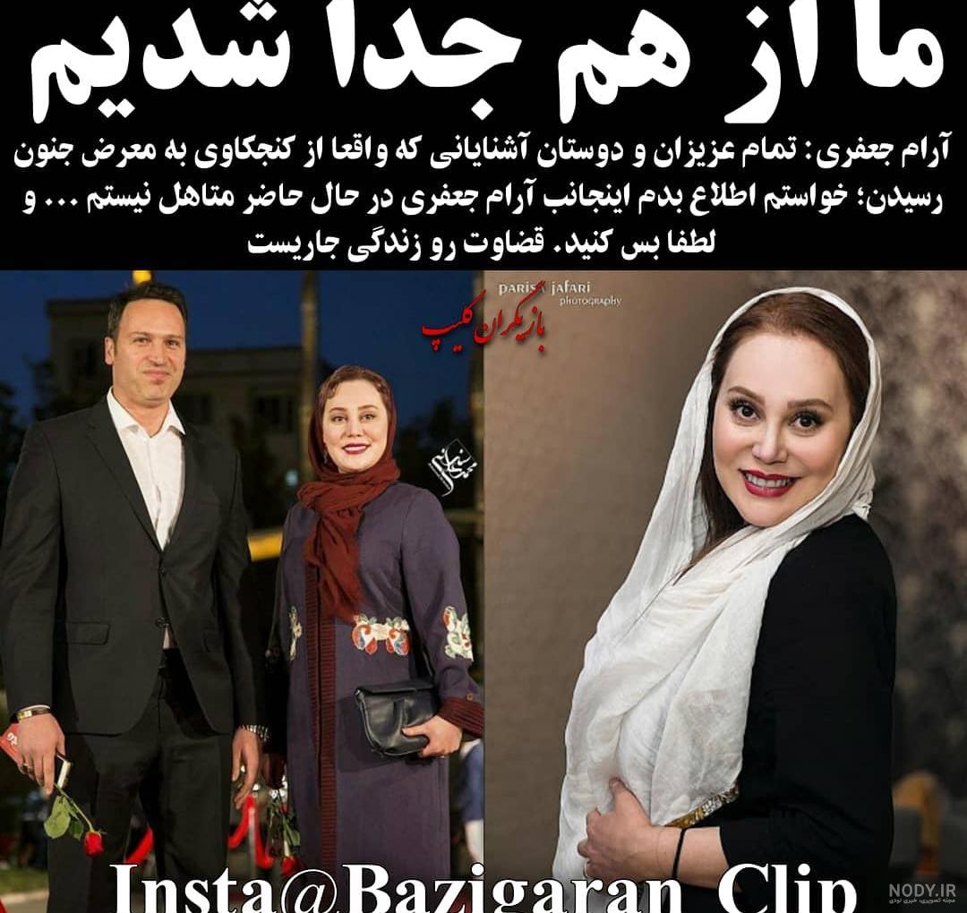 بازیگری که فکش فلج شد