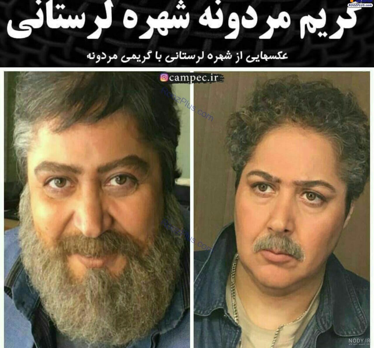 علت چاقی شهره لرستانی