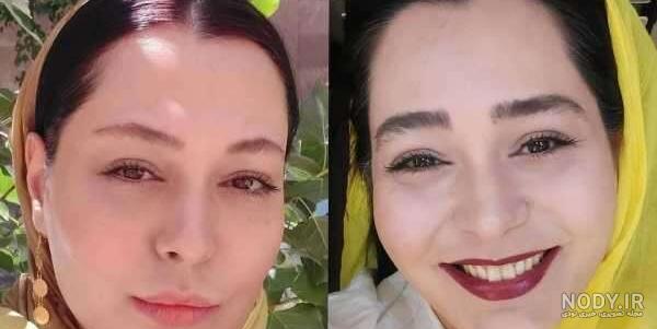 عکس سانیا سالاری بعد از عمل