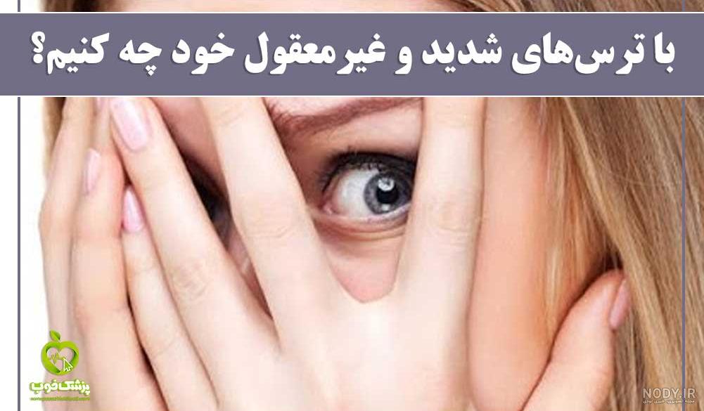 آیا آنابل در ایران وجود دارد