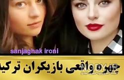 عکس سودا ارگینجی قبل از عمل زیبایی عکس سودا ارگینجی قبل از عمل زیبایی