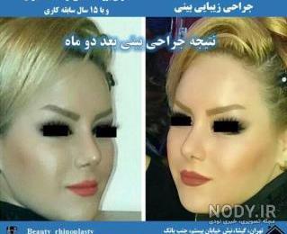 آزمایش کرونا قبل از عمل بینی آزمایش کرونا قبل از عمل بینی