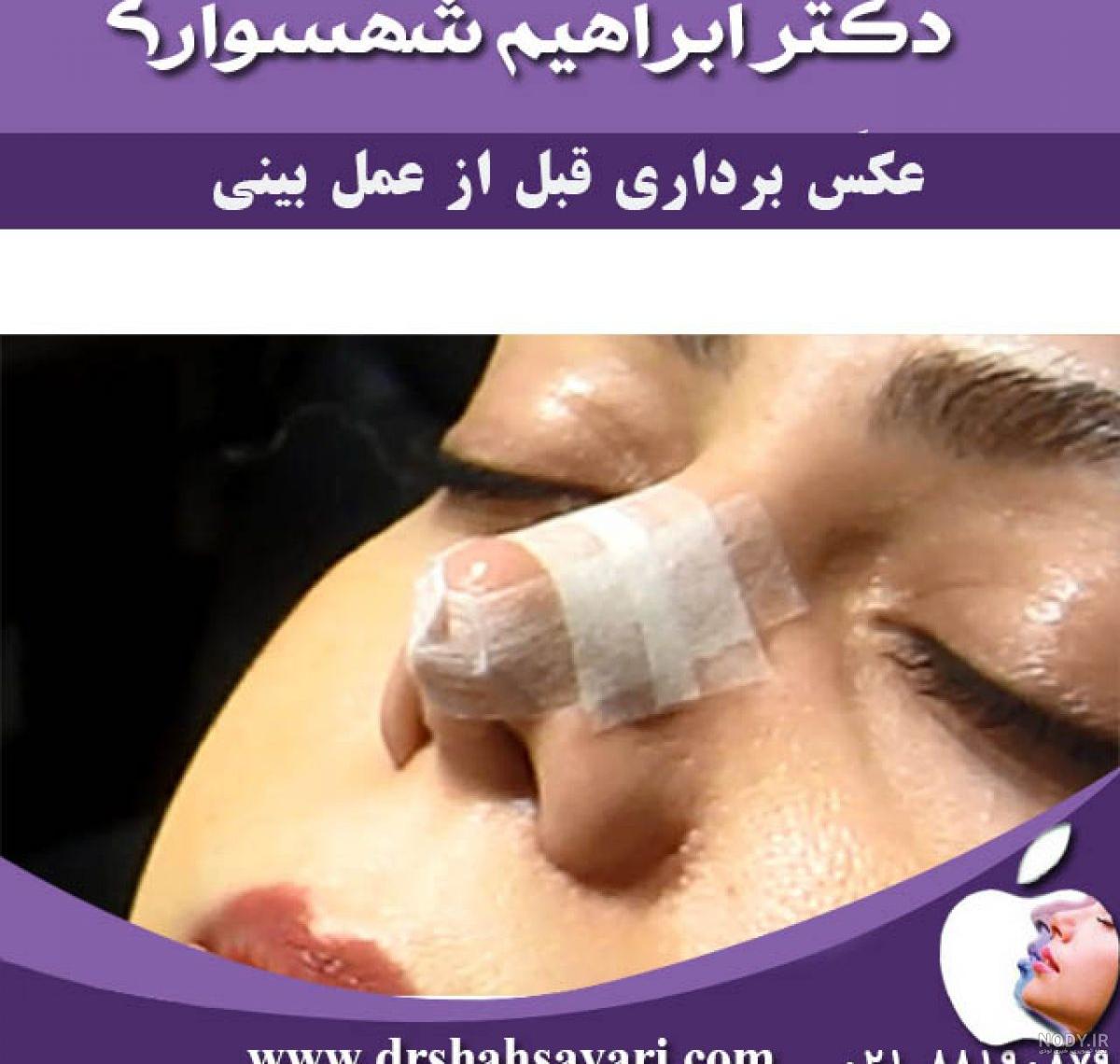 مراکز فتوگرافی بینی مراکز فتوگرافی بینی