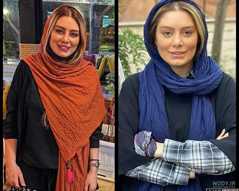 عکس جدید سحر قریشی بعد از عمل عکس جدید سحر قریشی بعد از عمل