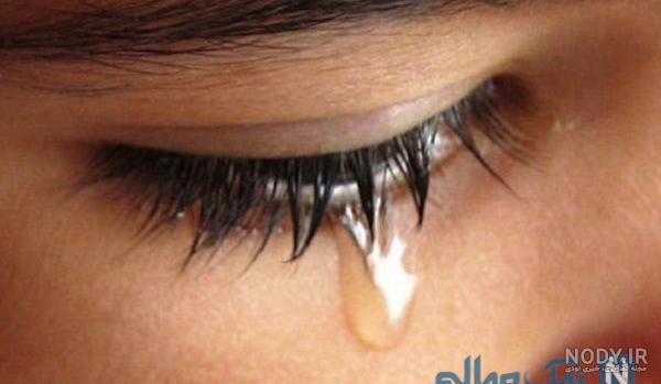 عکس چشم گریان قرمز عکس چشم گریان قرمز