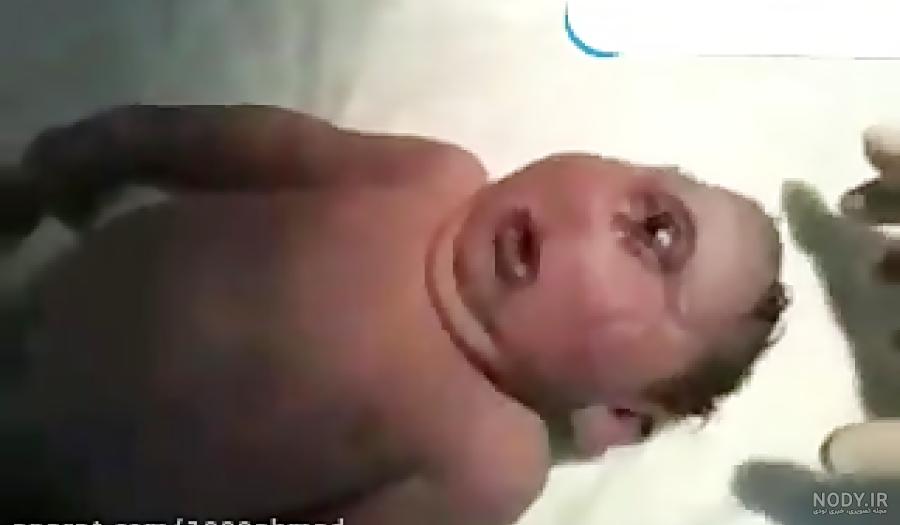 بچه سه چشم بچه سه چشم