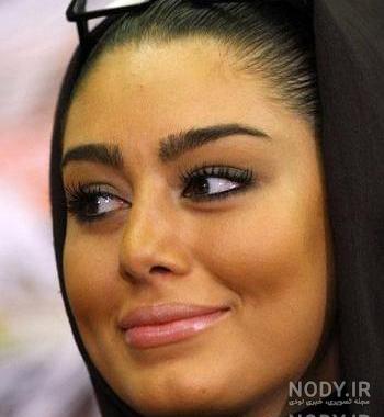 عکس سحر قریشی بعد از عمل عکس سحر قریشی بعد از عمل