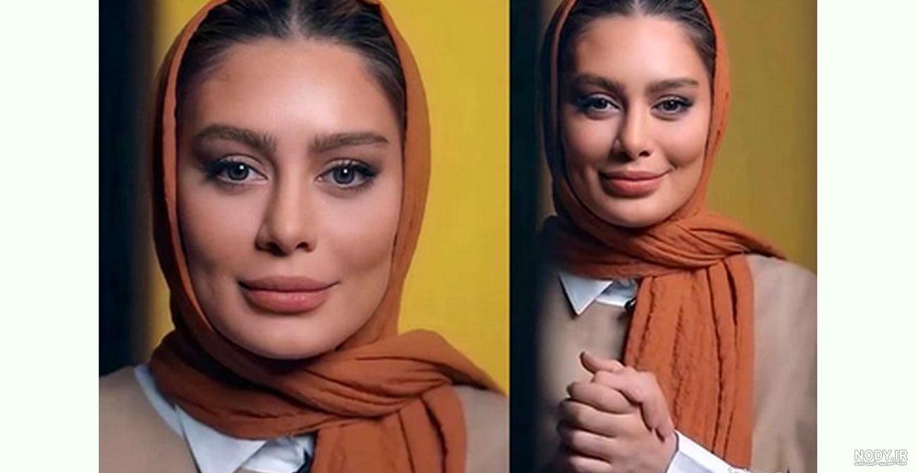 عکس سحر قریشی قبل عمل بینی