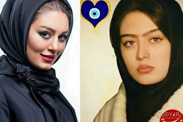 عکس سحر قریشی قبل عمل