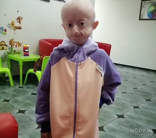 عکس بچه دو ساله عکس بچه دو ساله