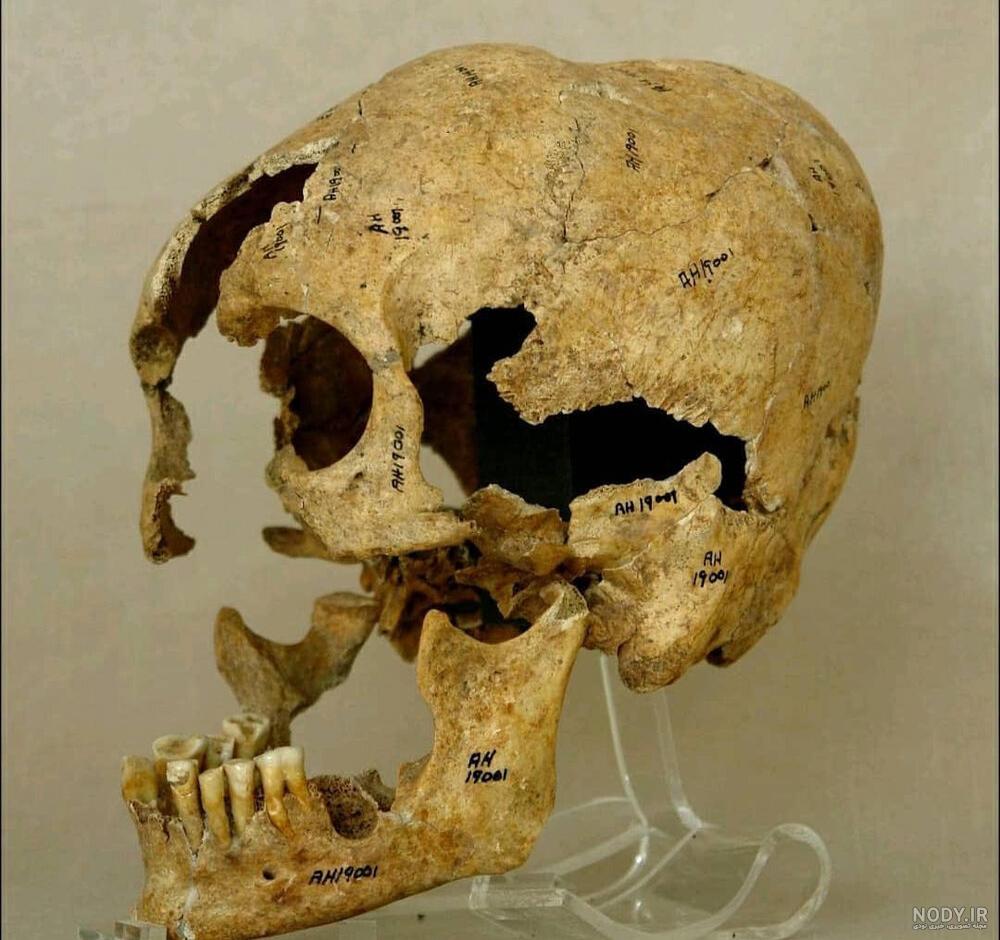 مرد نمکی چیست