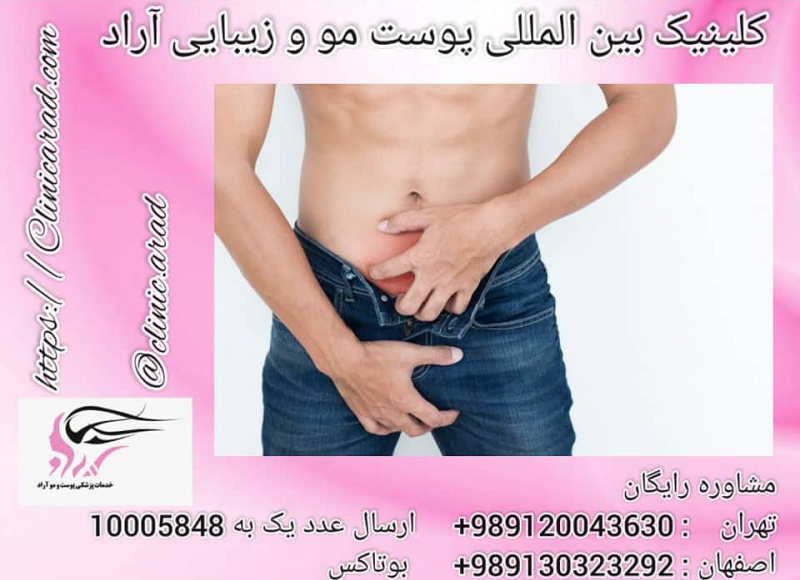 بهترین دستگاه لیزر موهای زائد نی نی سایت