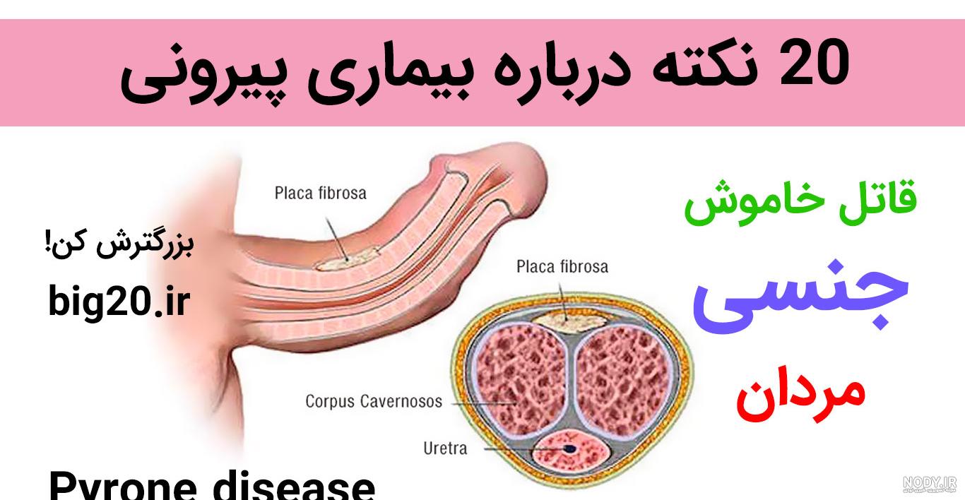 عکس دختر خوشگل نی نی سایت