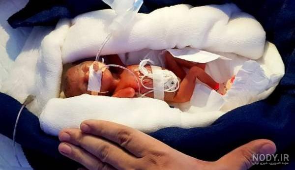 زشت ترین خرگوش دنیا