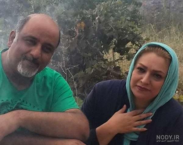 عکس لیلا میلانی قبل از عمل عکس لیلا میلانی قبل از عمل