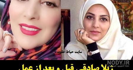 عکس واقعی ژیلا صادقی