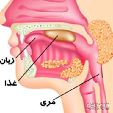 علائم سرطان گلو نی نی سایت