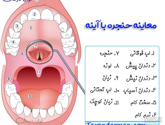 علائم سرطان گلو و لوزه