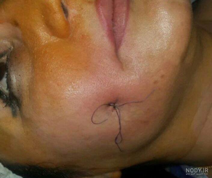 عمل چال گونه نی نی سایت