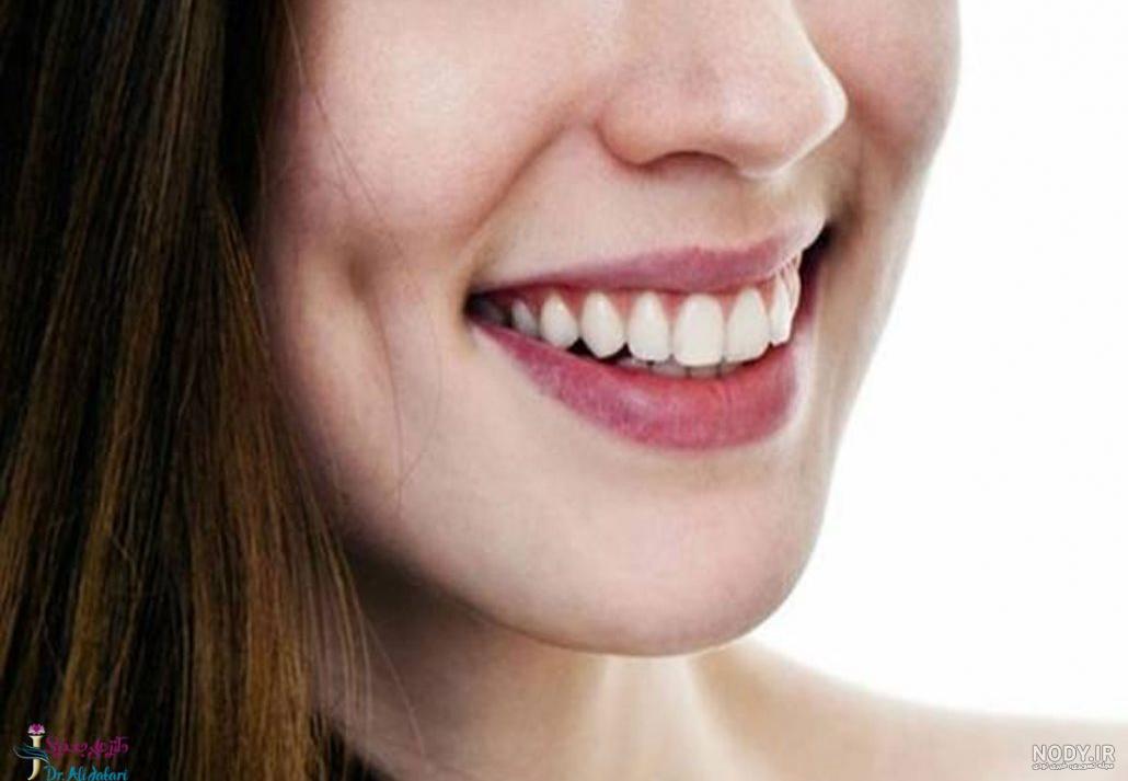 عمل چال گونه نی نی سایت