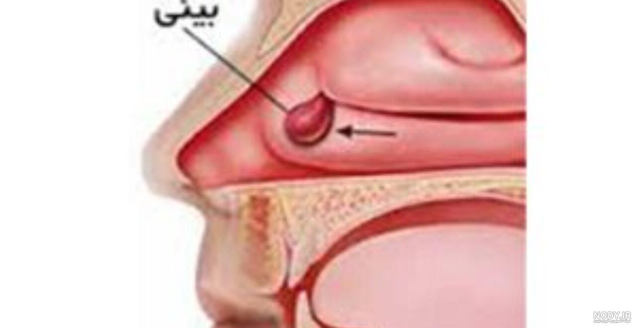 عکس از داخل بینی عکس از داخل بینی