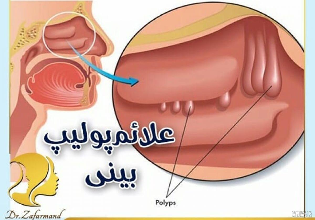 عکس داخل بینی انسان عکس داخل بینی انسان