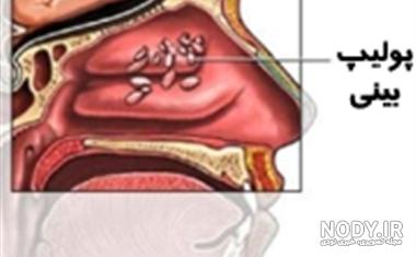 عکس داخل بینی سالم عکس داخل بینی سالم