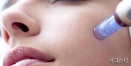 فیلم جراحی چال گونه