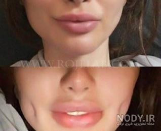 قیمت چال گونه