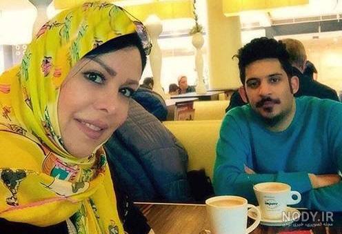 فلور نظری قبل عمل فلور نظری قبل عمل