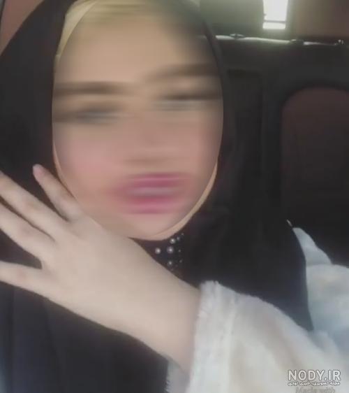 اینستاگرام شاخ و خز