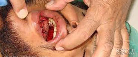 رژ لب فانتزی دخترانه رژ لب فانتزی دخترانه