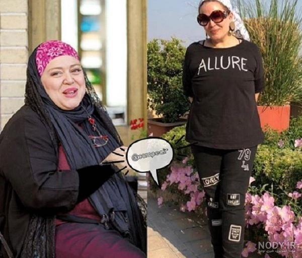 بهاره رهنما قبل و بعد عمل بینی بهاره رهنما قبل و بعد عمل بینی