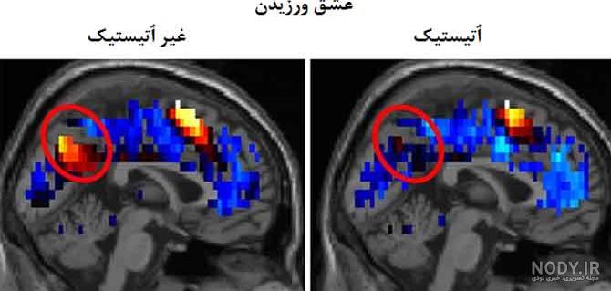 تفسیر ام ار ای مغز نی نی سایت