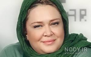 هزینه عمل اسلیو در بیمارستان میلاد؟ هزینه عمل اسلیو در بیمارستان میلاد؟