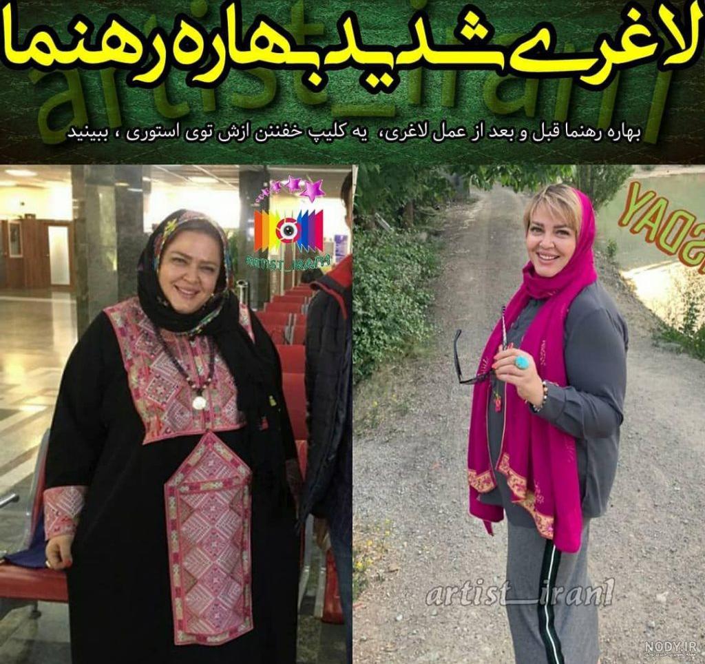 هزینه عمل لاغری بهاره رهنما هزینه عمل لاغری بهاره رهنما