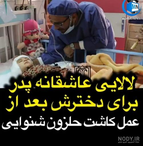 بهترین دکتر کاشت حلزون بهترین دکتر کاشت حلزون