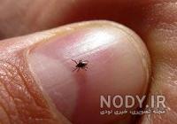 بهترین سم برای کنه قرمز اروپایی بهترین سم برای کنه قرمز اروپایی