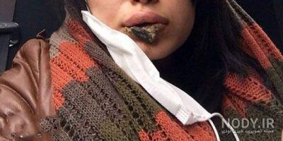 عکس لب وحشتناک