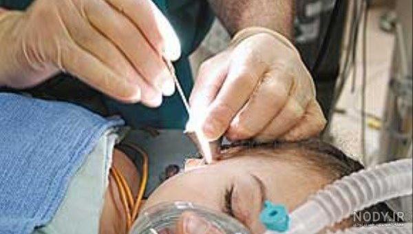 هزینه کاشت حلزون با دفترچه تامین اجتماعی هزینه کاشت حلزون با دفترچه تامین اجتماعی
