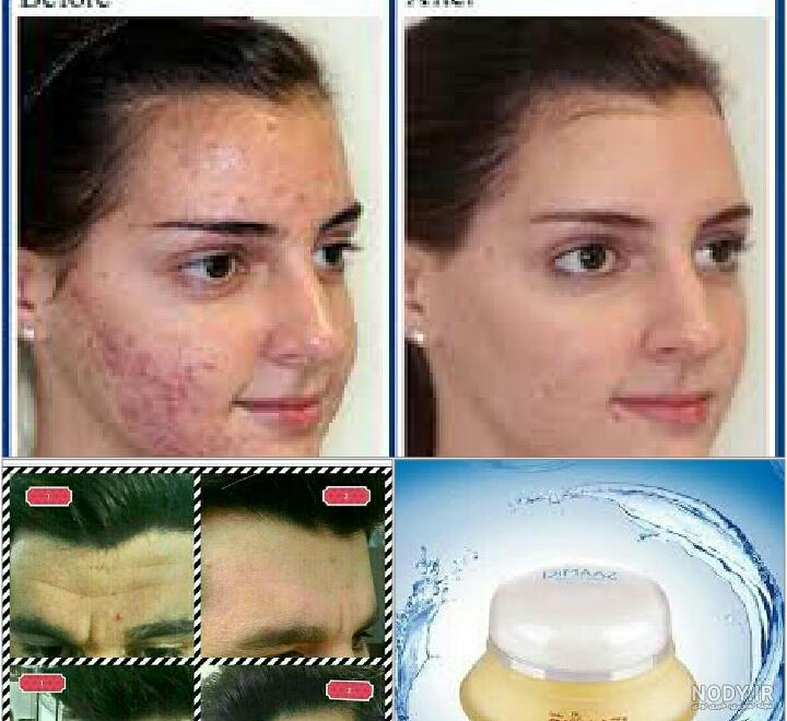 طریقه استفاده از کرم زعفران