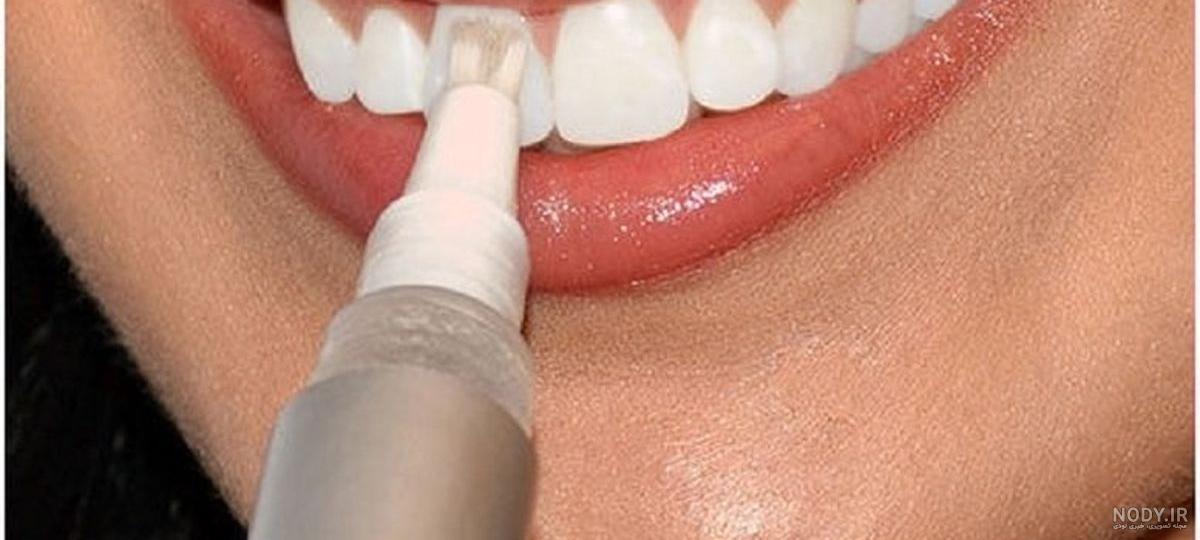 عکس دندانهای سفید