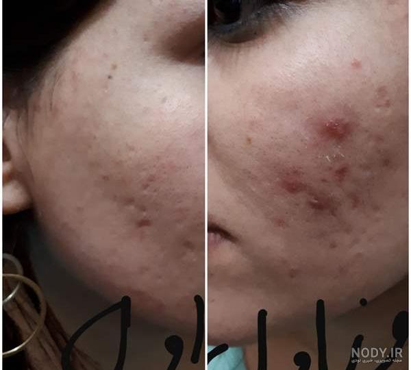 قیمت کرم زعفران